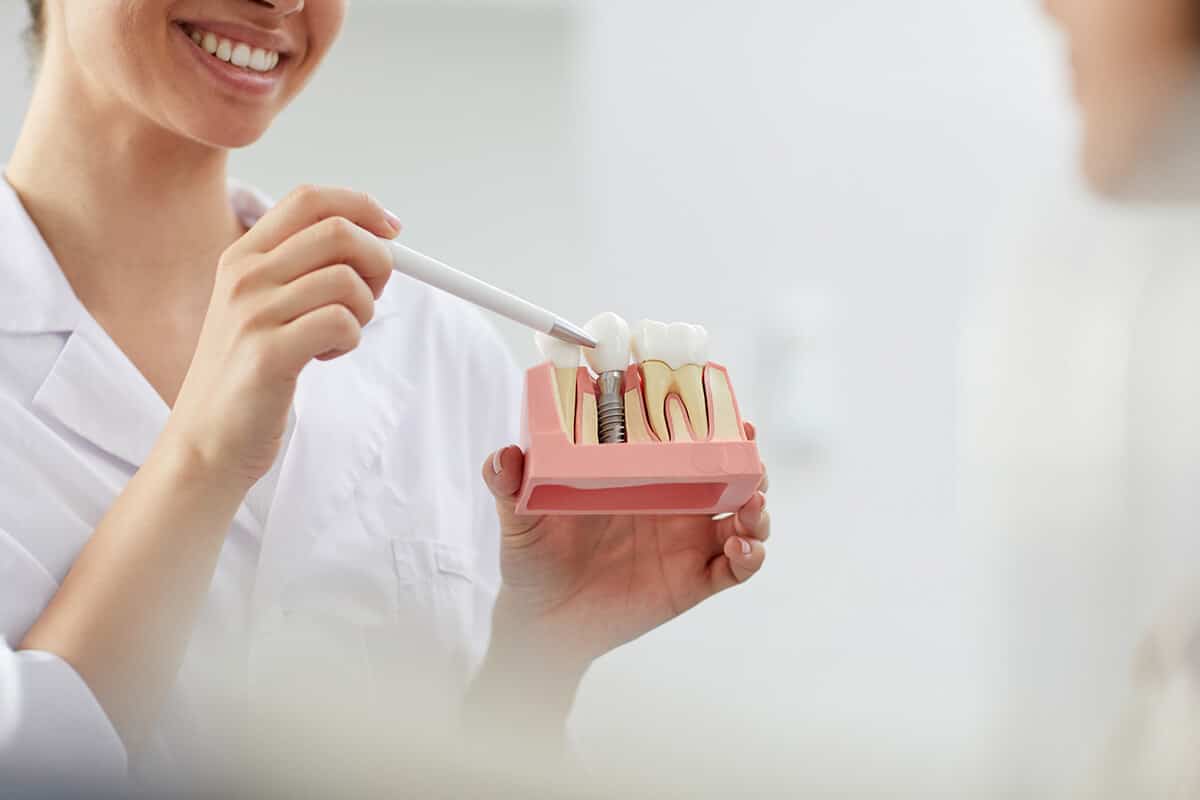 4 Myths About Dental Implants Blog Image