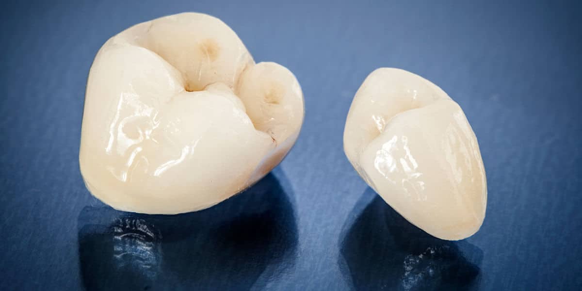 Dental Crowns Image