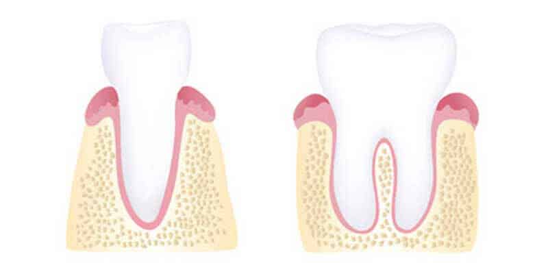 Healthy Gums Image