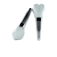 Dental Implants Image