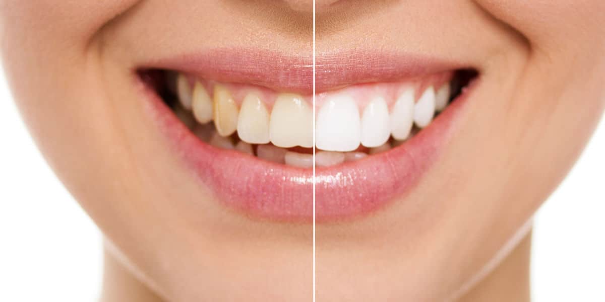 Whitening Image